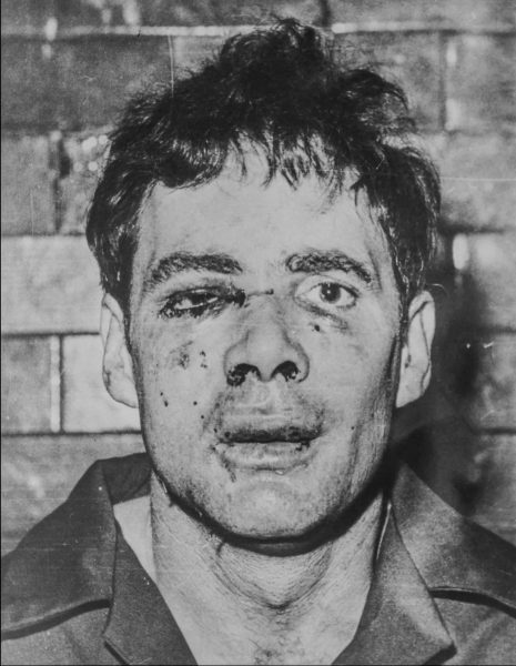 Lesley Whittle Battered The Day After His Arrest